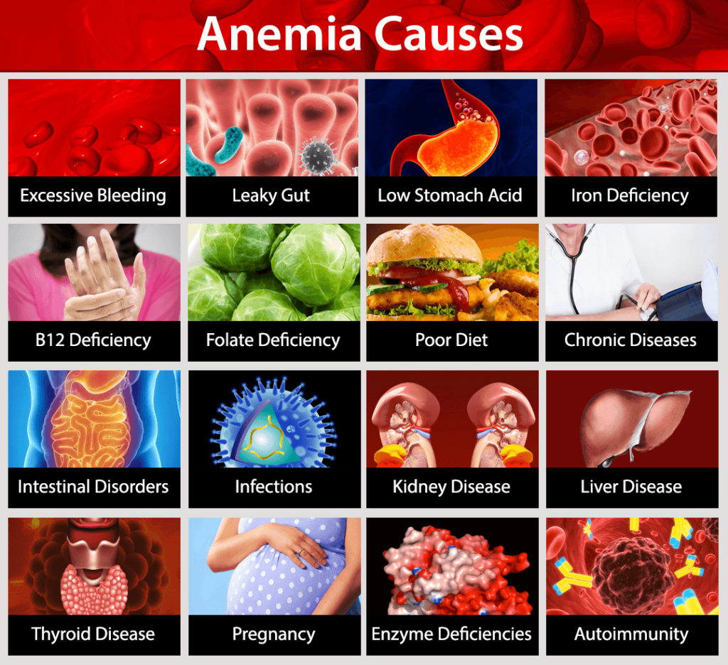 Image result for anemia causes