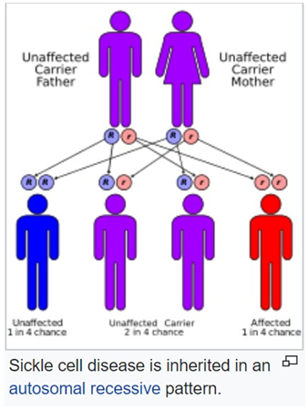 unaffected 
Carrier 
Sickle cell disease is inherited in an 
autosomal recessive pattern. 